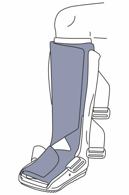 Easycast Application Step 2 Easycast Pneumatic Walker