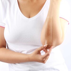 Scar Treat – Get rid of Scars