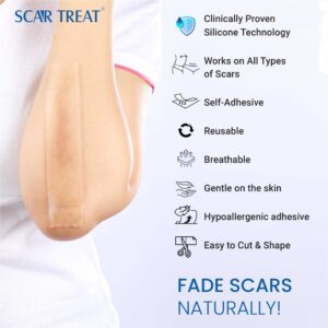 Scar Treat – Get rid of Scars