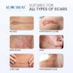 Scar Treat – Get rid of Scars