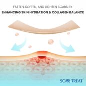 Scar Treat – Get rid of Scars