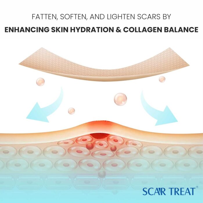 Scar Treat – Get rid of Scars
