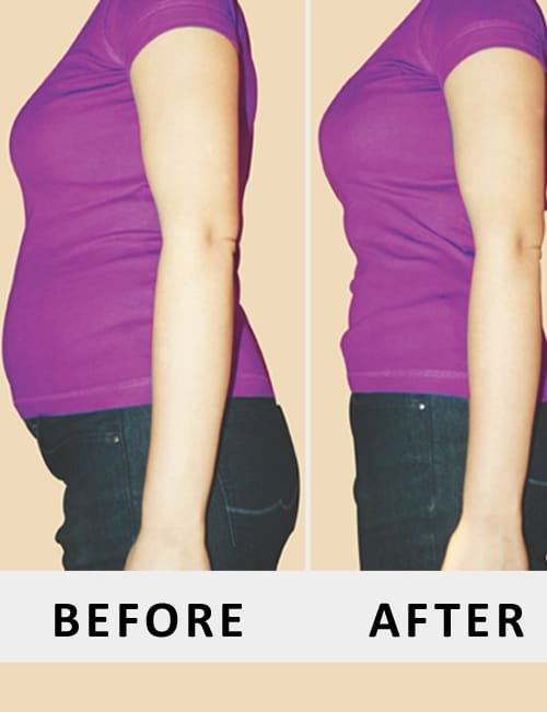 shaping belt