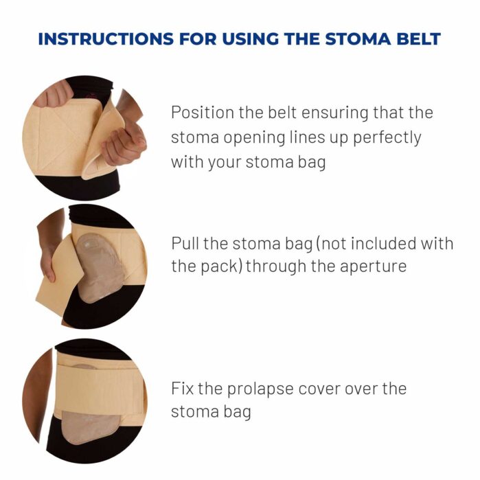 stoma belt | ostomy belt