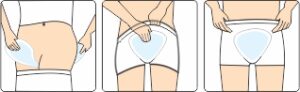 incontinence pad usage instructions