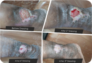 case study- 4LB