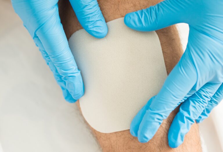 A Comprehensive Guide to AgFix Foam Silver Dressings – Part 1 – Introduction to Silver Dressings