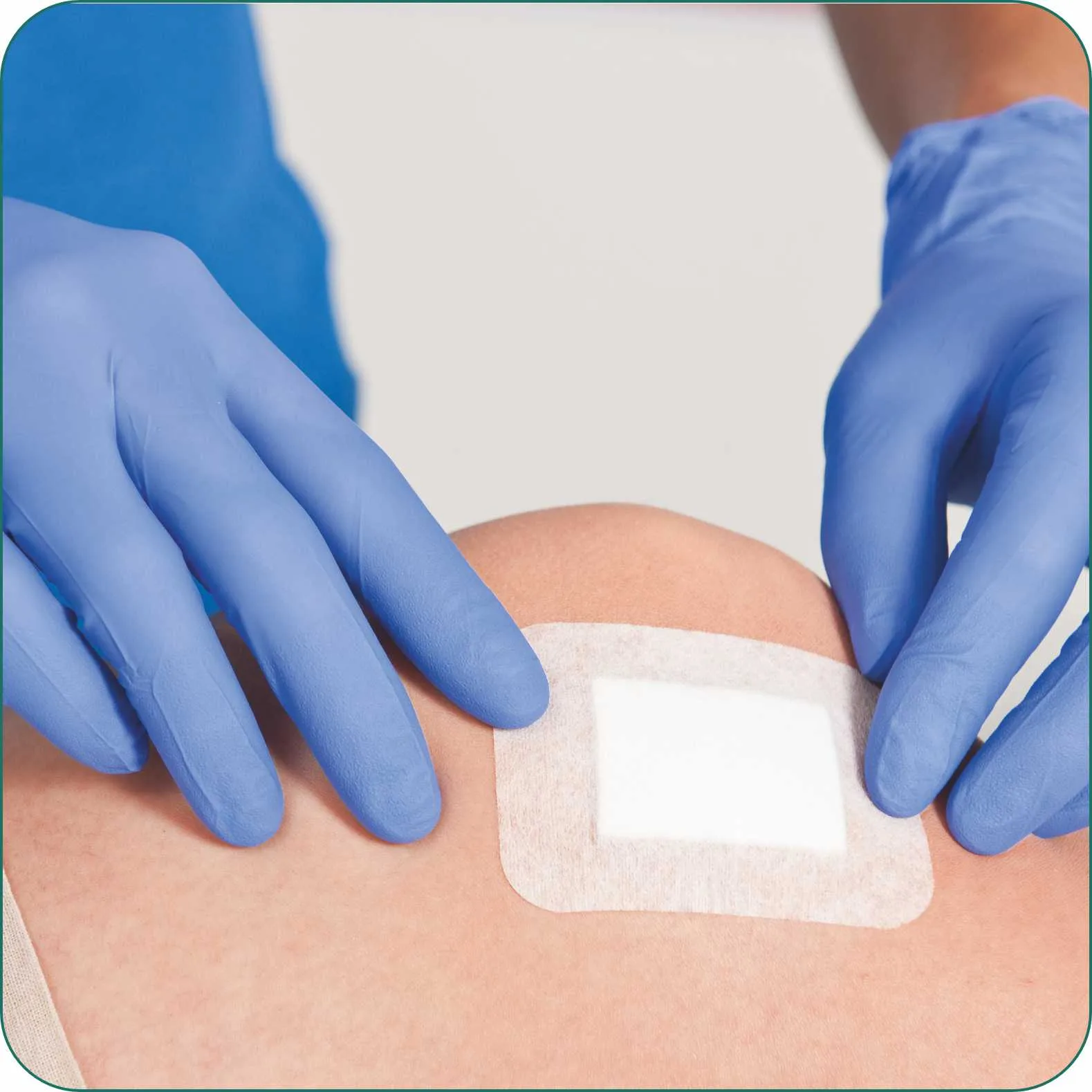 Sterizone NW Non-woven Adhesive Wound Dressing - Pack of 5