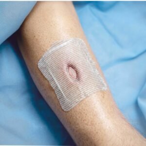 Silnet Silver Wound Dressing