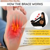 Night Derotation Brace