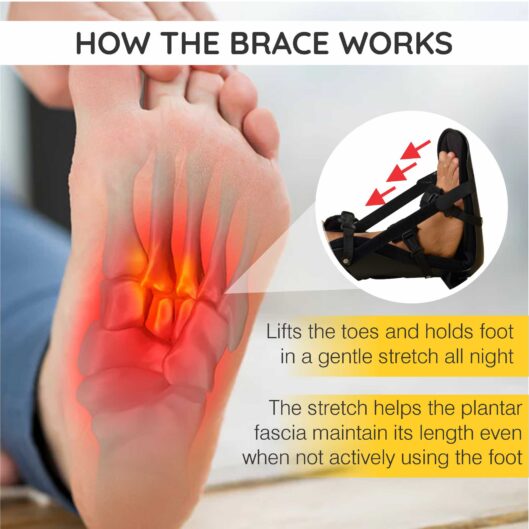 Night Derotation Brace