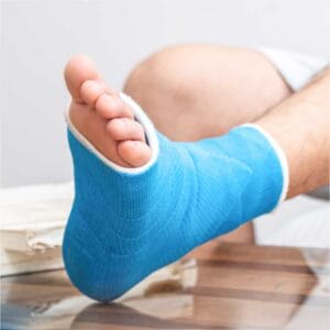 NovaCast Fibre Glass Cast Tape