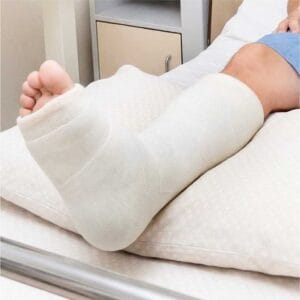 Plaster of Paris Bandage